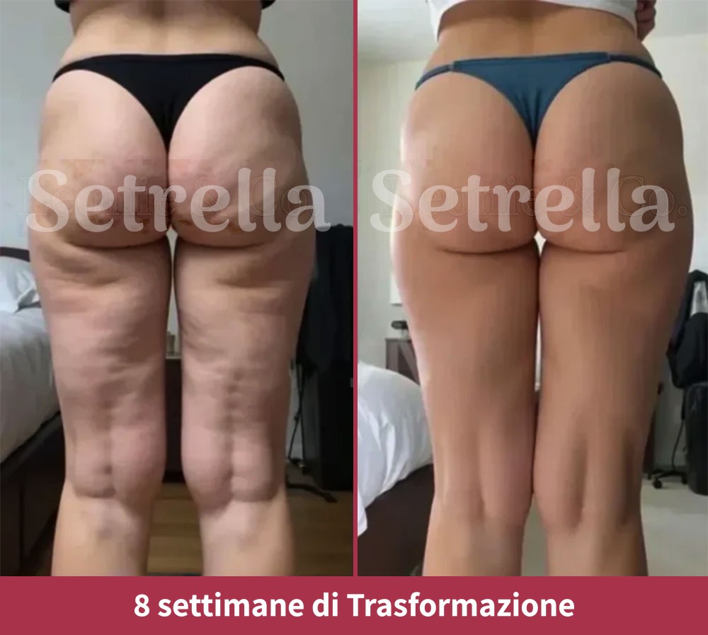 ab-setrella-it1.jpg