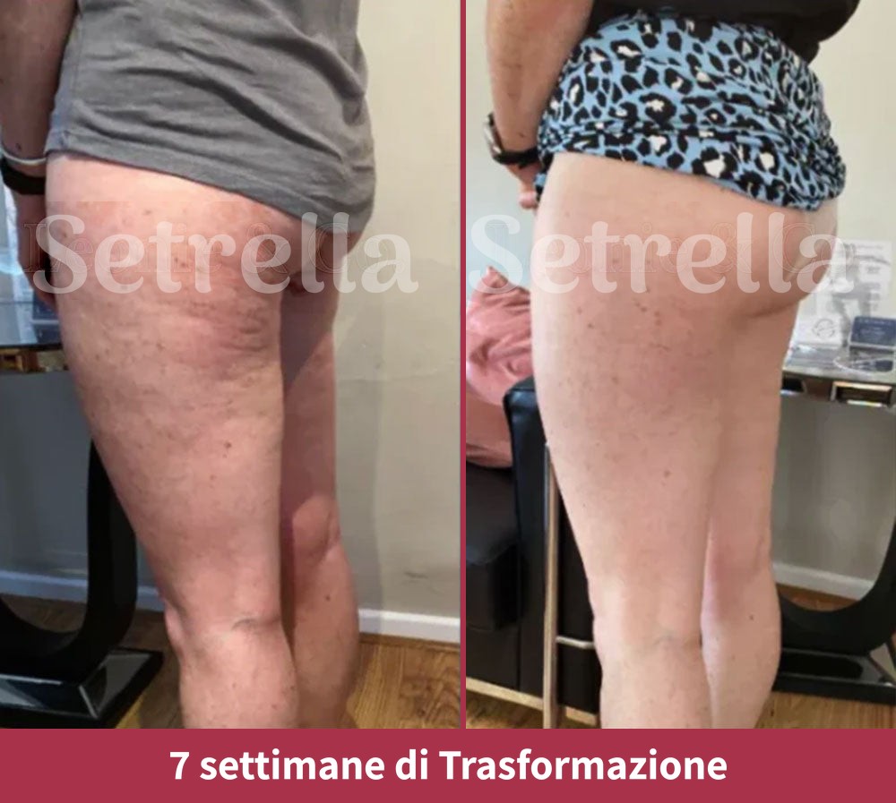 ab-setrella-it2a.jpg