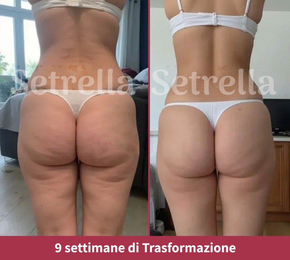 ab-setrella-it3a.jpg