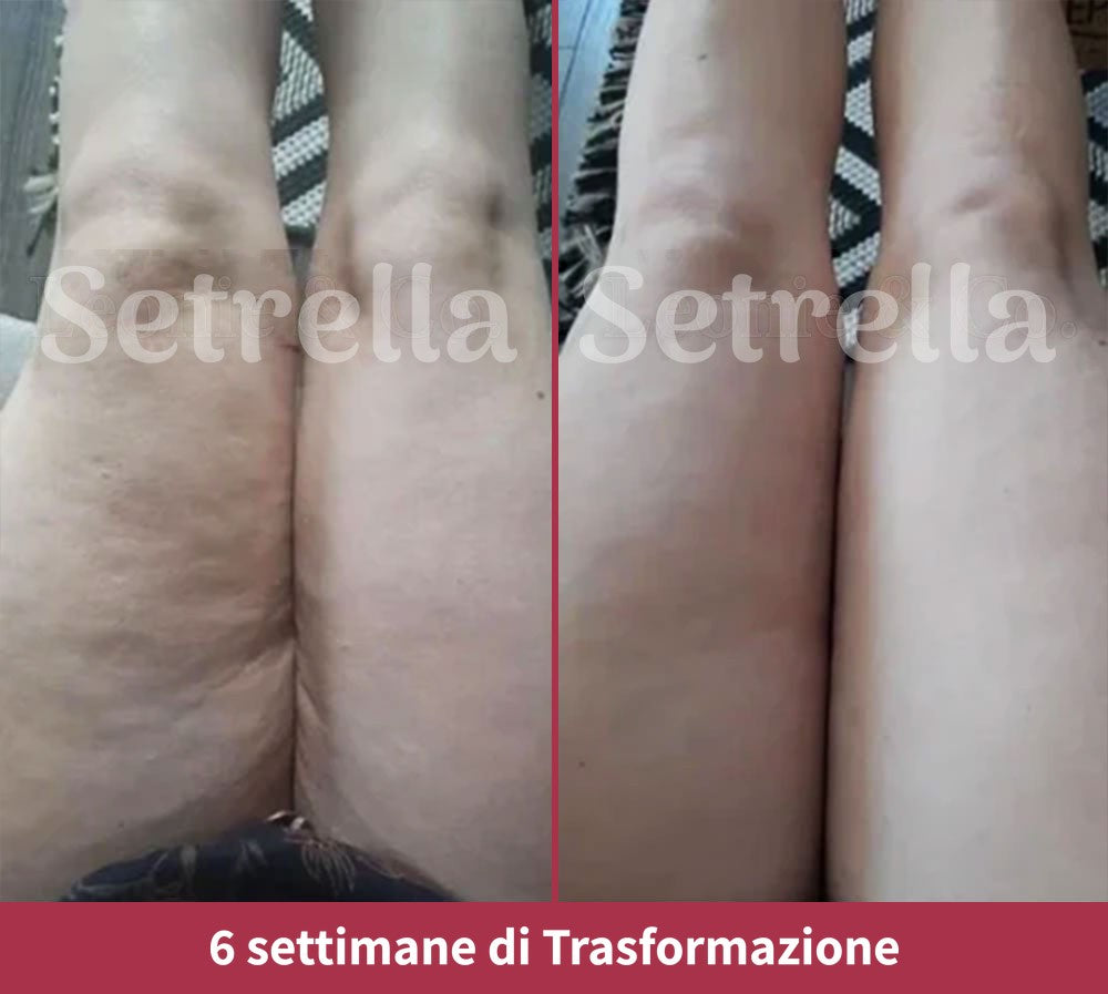 ab-setrella-it4.jpg