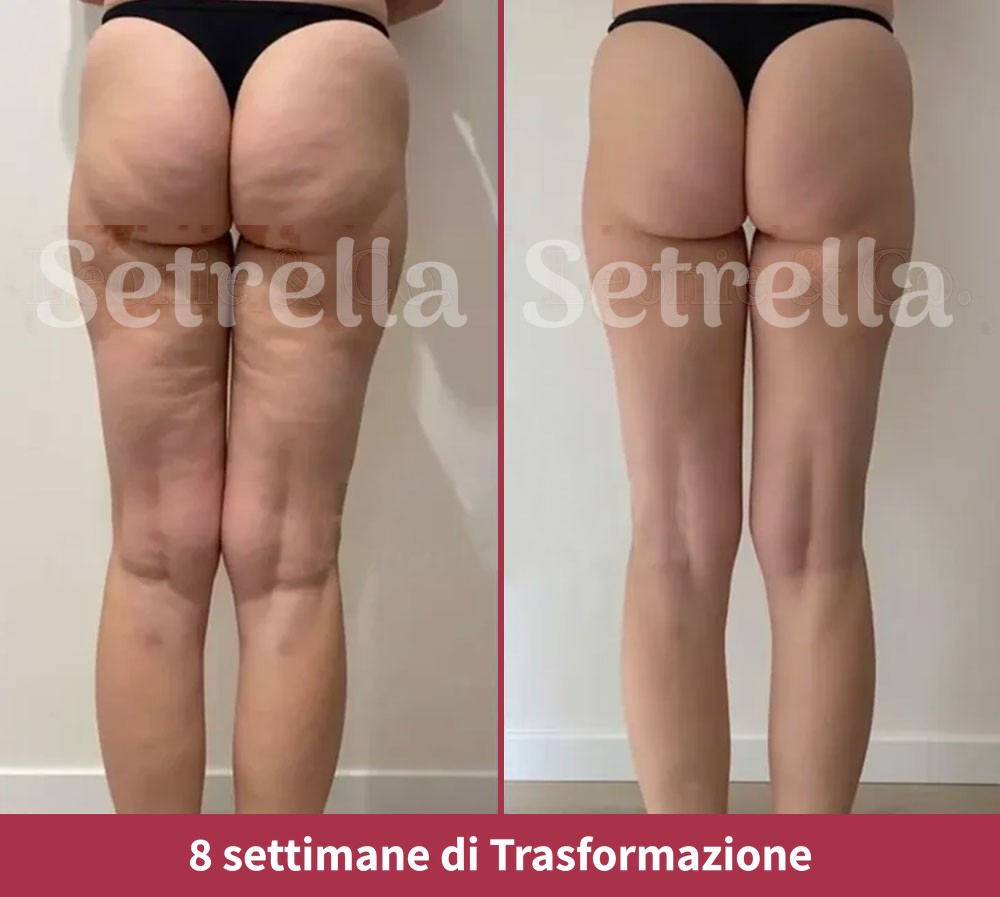 ab-setrella-it5.jpg